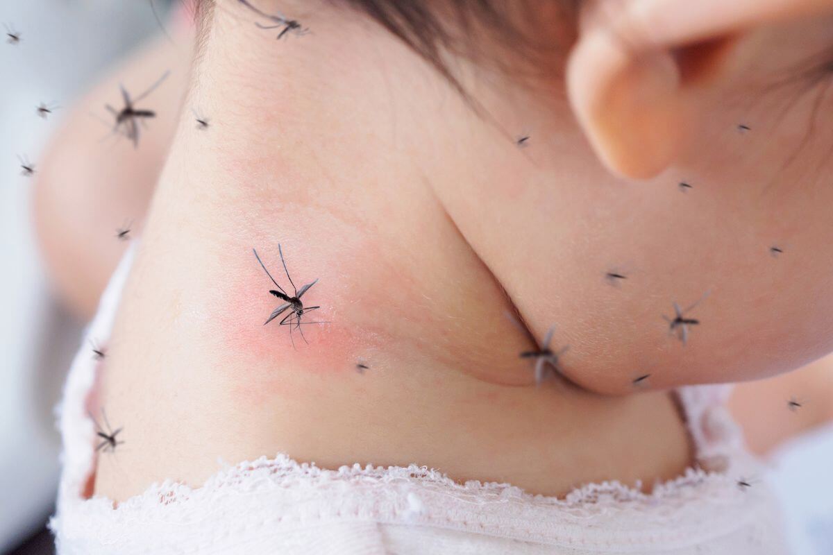 A child finds themselves plagued by mosquitoes buzzing around their neck.